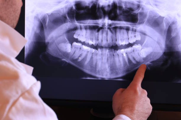 Best Emergency Treatment for Jaw Pain or Injury in Lonville, GA